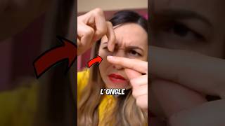 Si tu as un ongle comme ça ne fais surtout pas ça  💅❌ [upl. by Namurt297]