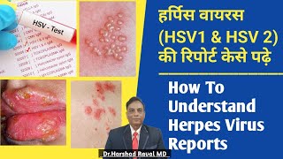 हर्पिस वायरस HSV1 amp HSV 2 की रिपोर्ट केसे पढ़े l How To Understand Herpes Virus Reports [upl. by Enyaw]