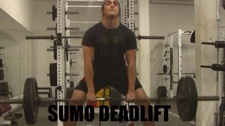 HOW To Sumo Deadlift Correct Technique for Size Strength and Performance [upl. by Oecam19]