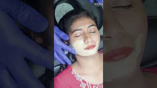 COSMELAN PEEL to treat hyperpigmentation [upl. by Akere]