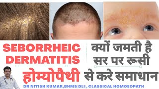 सर मे रुसीपपड़ी खुजली और लाली से परेशांन SEBORRHEIC DERMATITISDANDRUFF ITCHING ON CHILDREN SCALP [upl. by Ariait]