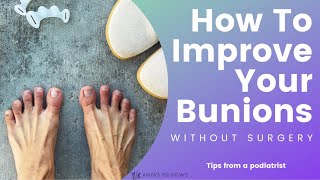 How To Improve Your Bunions Without Surgery  Natural Foot Care Tips From A Podiatrist [upl. by Meikah156]