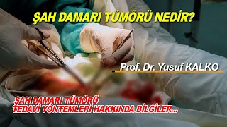 Şah Damarı Tümörü ve Belirtileri Nelerdir  Prof Dr Yusuf KALKO [upl. by Wrigley]