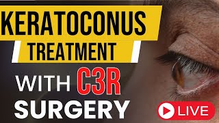 What Is Keratoconus I Keratoconus Treatment [upl. by Lole]