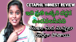 cetaphil honest review for all skip types cetaphil face wash cetaphil cleanser review for acne [upl. by Ahter]