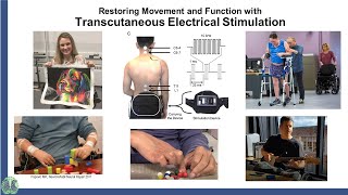 Restoring Movement and Function with Transcutaneous Electrical Stimulation [upl. by Ecinerev]