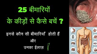 worms  Infection  homeopathicmedicine  Vaccination  Health  Diet  Fitness  Food [upl. by Anaul]