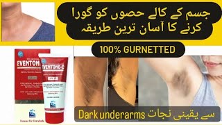 Whitening of Dark underarms  Eventone C cream uses [upl. by Magnusson733]