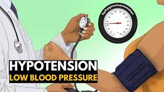 Low Blood Pressure or Hypotension Causes Signs and Symptoms Diagnosis and Treatment [upl. by Coraline]