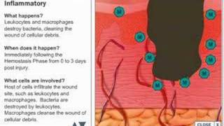 The Stages of Wound Healing [upl. by Mccartan]