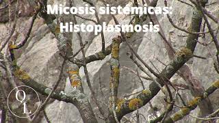 10 Micosis sistémicas Histoplasmosis [upl. by Ingold]