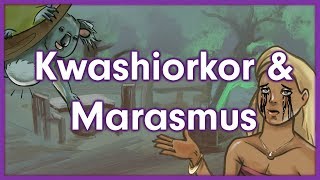 Kwashiorkor vs Marasmus  Nutrition Mnemonic [upl. by Aiekahs]