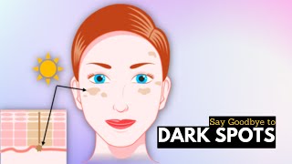 Say Goodbye To Dark Spots On Your Face With These Tips And Tricks [upl. by Acirrehs613]