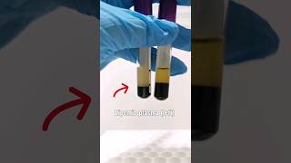 Lipemic plasma vs Normal plasma laboratory mls cls medtechstudent medtech lipemia lipoprotein [upl. by Peppy320]