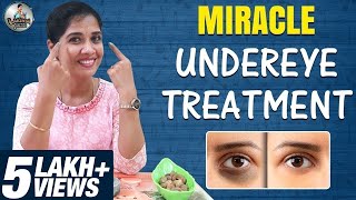 Eye Doctor Explains How To Get Rid Of Dark Under Eye Circles Naturally [upl. by Ytsirt]