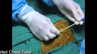 Guidewire inserted Chest tube in dog or cat MILA [upl. by Ymot]