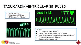 Clase 5 APH Ritmos de paro cardiaco [upl. by Enitsugua]