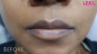 Lip Microblading Procedure Step by Step  Before amp After Lip Microblading Results  DNCC [upl. by Ainavi]