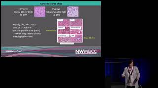 Lobular Breast Cancer How is it different from IDC and what does that mean for me [upl. by Marceau922]