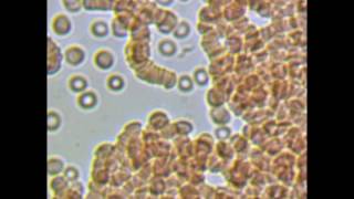 Trypanosomes in three different fresh blood preparations [upl. by Mcintosh]