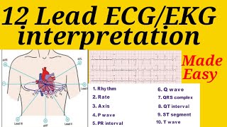 12 lead ECGEKG interpretation made easy with simple steps  12 lead ECG  ECG interpretation  ECG [upl. by Nosneh564]