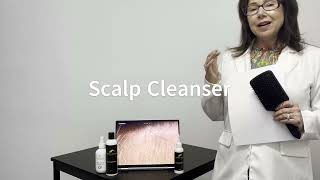 Scalp Treatment Solution [upl. by Anselme334]