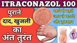 Itraconazole Capsule 200100mgitratek Capsule Use Dose Side Effects and Price in Hindi [upl. by Nyletac]