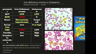 Iron deficiency s Thalassemia [upl. by Benioff]