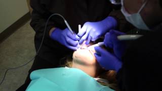 Peoria Dentist  Filling a cavity using Air Abrasion [upl. by Libbna]