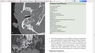 NEURORADIOLOGY CORE REQUISITES [upl. by Rocco]