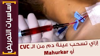 اساسيات التمريض  15 إزاي تسحب عينة دم من الـ CVC او الـ Mahurkar بطريقة صحيحة؟ [upl. by David145]