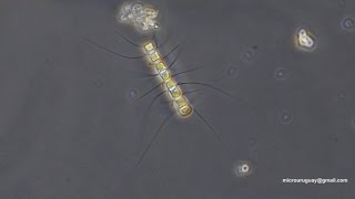 Chaetoceros diatomeas  diatoms [upl. by Yenffit]