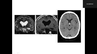 CNS spotting lecture 1 part 2 [upl. by Garbers]