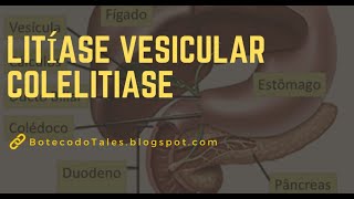 LITÍASE VESICULAR  COLELITIASE [upl. by Kristal]