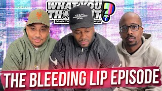 What You Thought 152 The Bleeding Lip Episode  The Funniest Podcast On The Planet [upl. by Rab]