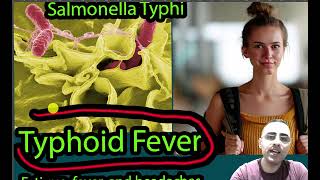 Typhoid Fever Symptoms Causes and treatment [upl. by Anaugal]