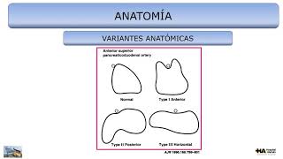 ANOMALÍAS PÁNCREAS POR TOMOGRAFÍA [upl. by Waldman]