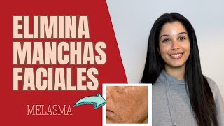 Top 8 Ingredientes para Tratar el MELASMA y la HIPERPIGMENTACIÓN  Enfermera Dermoestética [upl. by Notecnirp824]