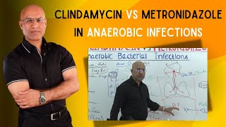 Clindamycin vs Metronidazole  Anaerobic Infections [upl. by Amaris416]