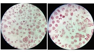 LeptoteneZygotenePachyteneDiplotene amp Diakinesis stages of meiosis with identifying characters [upl. by Zelikow]