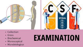 CSF Examination  Cerebrospinal Fluid  Collection  Gross  Biochemistry  Microscopy [upl. by Monagan]