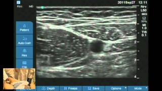 Ultrasound guided obturator and saphenous nerve block workshop [upl. by Aldis106]