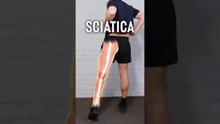 Sciatica amp coccyx Pain Relief ✅sciatica sciaticarelief sciaticapain coccyxpain shorts [upl. by Ecilahc]