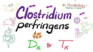 Clostridium perfringens Diagnosis and Treatment  Microbiology 🧫 amp Infectious Diseases [upl. by Selij]