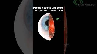 Treatment of Glaucoma  Laser surgery [upl. by Peria]