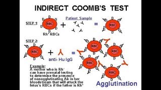 Indirect Coomb Test ICT [upl. by Adamski]