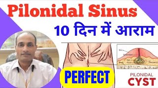 What is Pilonydal Sinus  Best Homeopathic Medicine for Pilonidal Cyst  Pilonidal Sinus Treatment [upl. by Negroj]