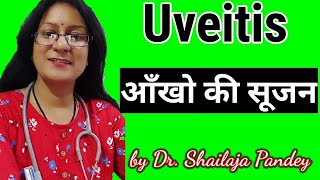 Uveitis treatment of uveitis यूवाइटिस आंखों की सूजन uveitis [upl. by Renat769]