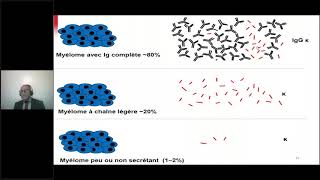 GAMMAPATHIE MONOCLONALE ROLE DU LABORATOIRE [upl. by Eisteb]