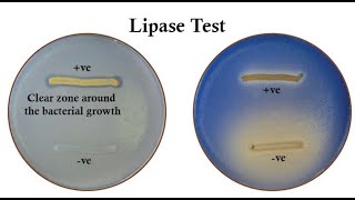 Lipase Test A Biochemical Test for Lipase Producing Bacteria Differentiation from other Bacteria [upl. by Appel609]